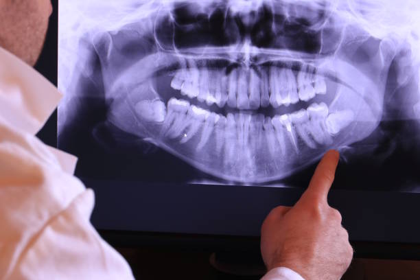 Best Emergency Dental Care for Broken or Chipped Teeth in Reedley, CA
